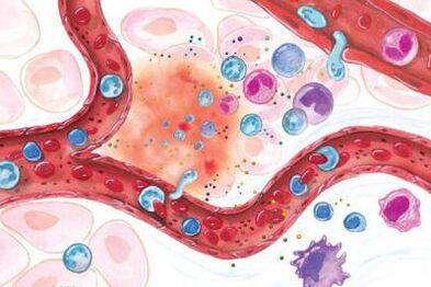 Effet du Boswellia sur les zones enflammées du corps